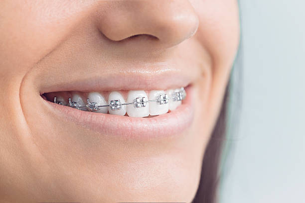 Best Invisalign and Clear Aligners  in Lackland Af, TX